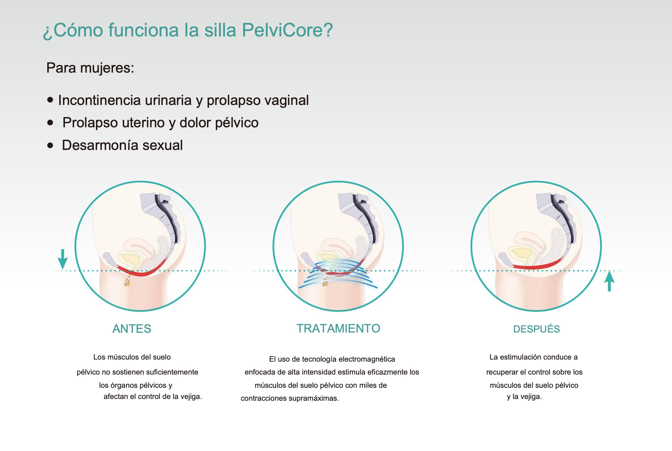 PelviCore Chair EMS - Imagen 7