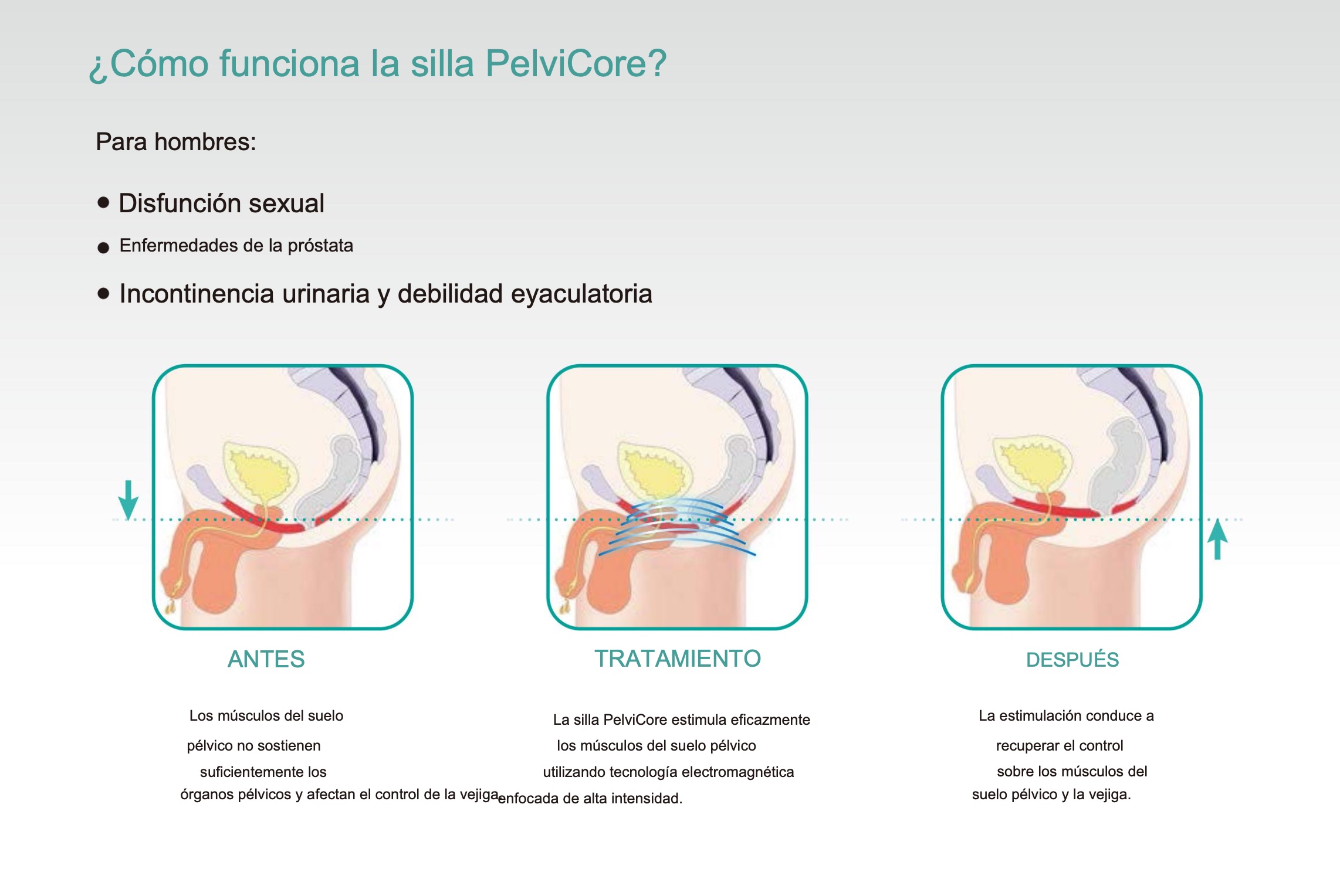 PelviCore Chair EMS - Imagen 8